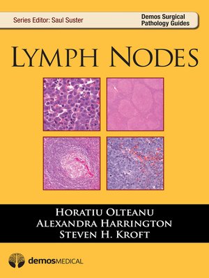 cover image of Lymph Nodes